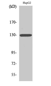 CSF2RB / CD131 Antibody - Western blot analysis of lysates from HepG2 cells, using IL-3R beta Antibody.