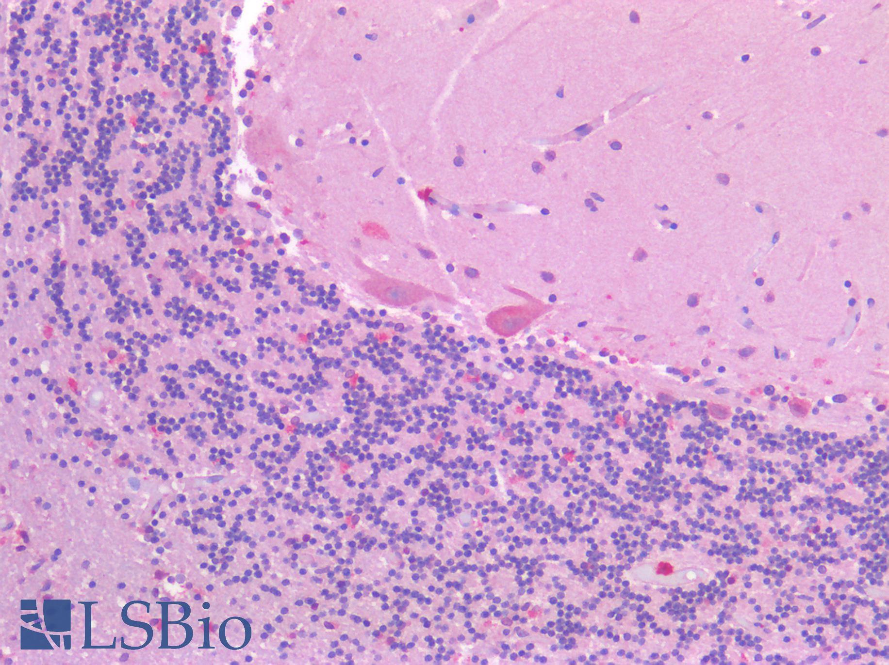 CSMD1 Antibody - Human Brain, Cerebellum: Formalin-Fixed, Paraffin-Embedded (FFPE)