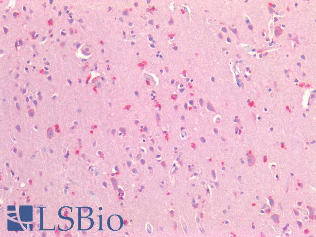 CSMD1 Antibody - Human Brain, Cortex: Formalin-Fixed, Paraffin-Embedded (FFPE)