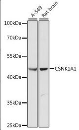 CSNK1A1 / CK1 Alpha Antibody - Western blot - CSNK1A1 Polyclonal Antibody