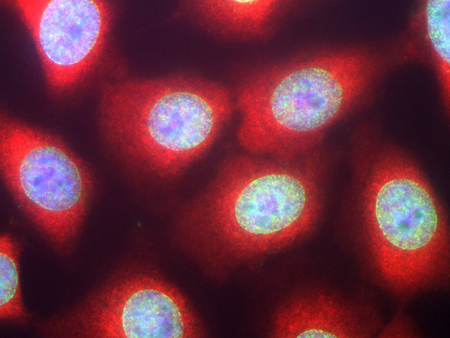 CSNK1A1 / CK1 Alpha Antibody - High power image of HeLa cells stained with chicken casein kinase 1 alpha antibody (red) and our panspecific mouse monoclonal antibody to nuclear pore complexes MCA-39C7 (green). Casein kinase 1 alpha has a particulate distribution both in the nucleus and the cytoplasm. Blue is the Hoeschst DNA stain. High quality immunocytochemical images made using this antibody are shown in reference 4.