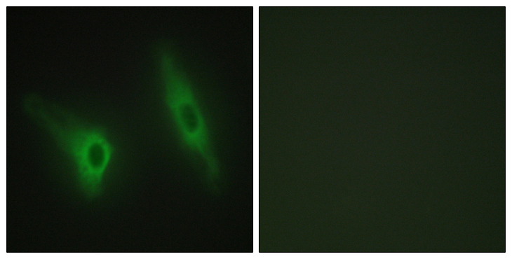 CSNK1E / CK1 Epsilon Antibody - Immunofluorescence analysis of HeLa cells, using CKI-epsilon Antibody. The picture on the right is blocked with the synthesized peptide.
