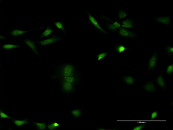 CSNK1E / CK1 Epsilon Antibody - Immunofluorescence of monoclonal antibody to CSNK1E on HeLa cell . [antibody concentration 10 ug/ml]