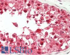 CSNK2A2 Antibody - Human Testis: Formalin-Fixed, Paraffin-Embedded (FFPE).  This image was taken for the unconjugated form of this product. Other forms have not been tested.