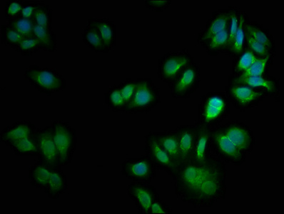 CSNK2A2 Antibody - Immunofluorescence staining of HepG2 cells with CSNK2A2 Antibody at 1:66, counter-stained with DAPI. The cells were fixed in 4% formaldehyde, permeabilized using 0.2% Triton X-100 and blocked in 10% normal Goat Serum. The cells were then incubated with the antibody overnight at 4°C. The secondary antibody was Alexa Fluor 488-congugated AffiniPure Goat Anti-Rabbit IgG (H+L).