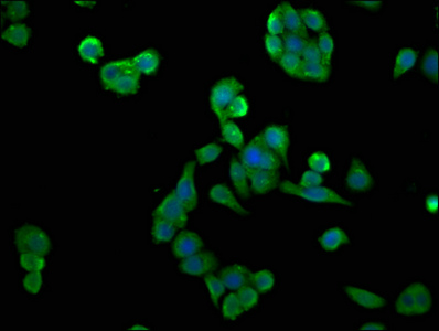 CSNK2A2 Antibody - Immunofluorescence staining of PC-3 cells with CSNK2A2 Antibody at 1:133, counter-stained with DAPI. The cells were fixed in 4% formaldehyde, permeabilized using 0.2% Triton X-100 and blocked in 10% normal Goat Serum. The cells were then incubated with the antibody overnight at 4°C. The secondary antibody was Alexa Fluor 488-congugated AffiniPure Goat Anti-Rabbit IgG(H+L).