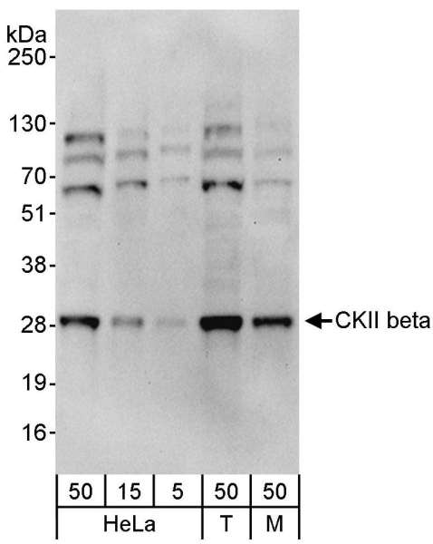 CSNK2B / Phosvitin Antibody - Detection of Human and Mouse CKII beta by Western Blot. Samples: Whole cell lysate from HeLa (5, 15 and 50 ug), 293T (T; 50 ug) and mouse NIH3T3 (M; 50 ug) cells. Antibodies: Affinity purified rabbit anti-CKII beta antibody used for WB at 0.04 ug/ml. Detection: Chemiluminescence with an exposure time of 30 seconds.
