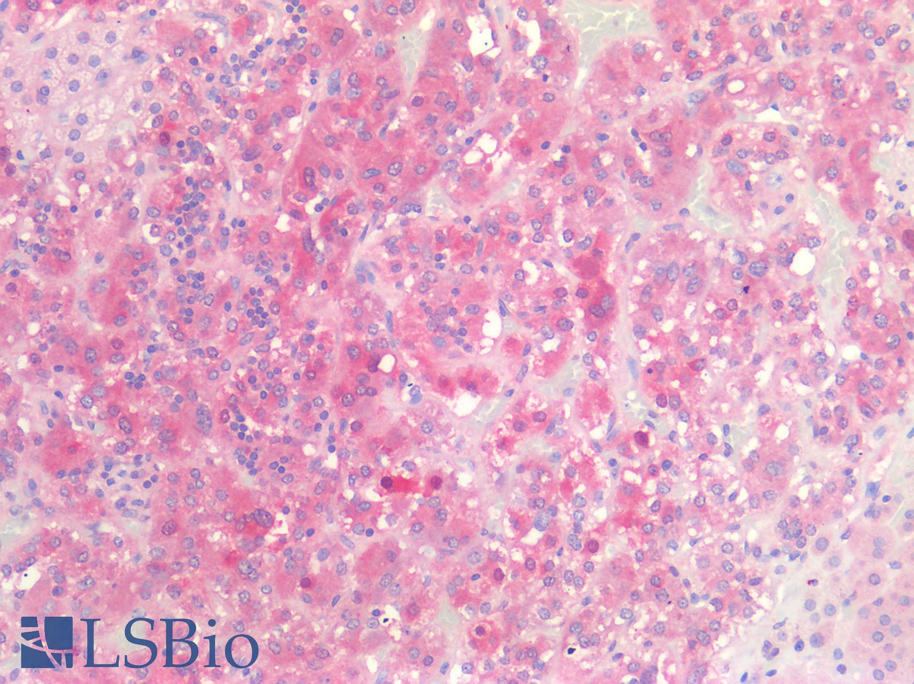 CSPG4 / NG2 Antibody - Human Adrenal: Formalin-Fixed, Paraffin-Embedded (FFPE)