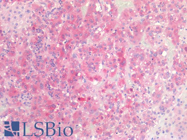 CSPG4 / NG2 Antibody - Human Adrenal: Formalin-Fixed, Paraffin-Embedded (FFPE)