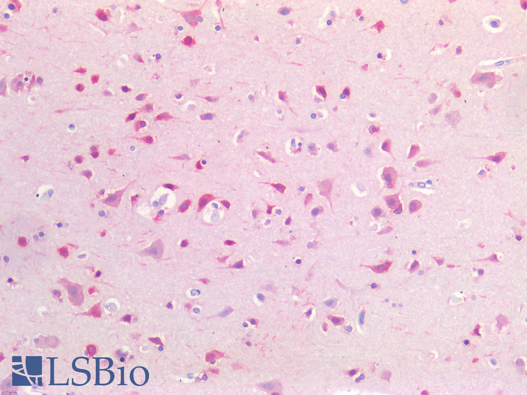 CSPG4 / NG2 Antibody - Human Brain, Cortex: Formalin-Fixed, Paraffin-Embedded (FFPE)