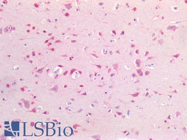 CSPG4 / NG2 Antibody - Human Brain, Cortex: Formalin-Fixed, Paraffin-Embedded (FFPE)