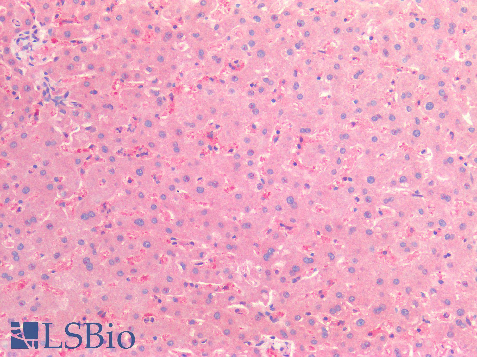 CSPG4 / NG2 Antibody - Human Liver: Formalin-Fixed, Paraffin-Embedded (FFPE)