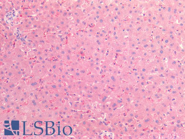 CSPG4 / NG2 Antibody - Human Liver: Formalin-Fixed, Paraffin-Embedded (FFPE)