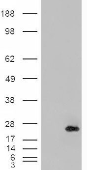 CSRP2 Antibody - CRP2 / CSRP2 antibody (0.2µg/ml) staining of Human (A), Mouse (B) and Rat (C) Kidney lysates (35µg protein in RIPA buffer). Detected by chemiluminescence