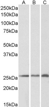 CSRP2 Antibody - CRP2 / CSRP2 Antibody (0.2µg/ml) staining of Human (A), Mouse (B) and Rat (C) Kidney lysates (35µg protein in RIPA buffer). Detected by chemiluminescencence
