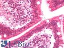 CSRP2BP Antibody - Human Small Intestine: Formalin-Fixed, Paraffin-Embedded (FFPE)