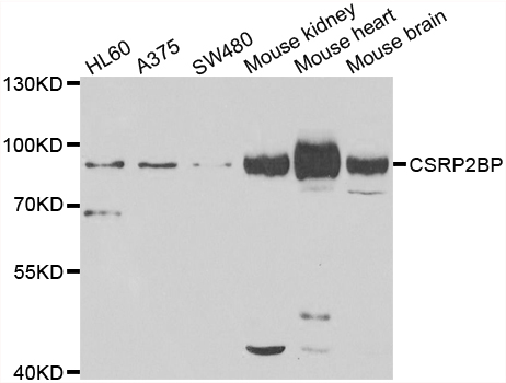 CSRP2BP Antibody - Western blot analysis of extracts of various cell lines.