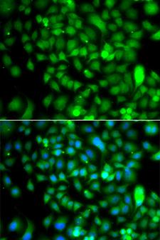 CSRP2BP Antibody - Immunofluorescence analysis of A549 cells.