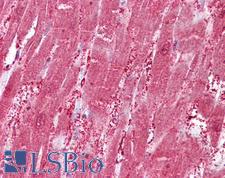 CSRP3 Antibody - Anti-CSRP3 antibody IHC of human heart. Immunohistochemistry of formalin-fixed, paraffin-embedded tissue after heat-induced antigen retrieval. Antibody concentration 2.5 ug/ml.