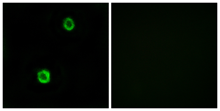 CST1 / Cystatin SN Antibody - Immunofluorescence analysis of MCF7 cells, using CST1 Antibody. The picture on the right is blocked with the synthesized peptide.