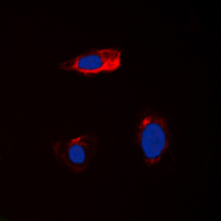CST1 / Cystatin SN Antibody - Immunofluorescent analysis of Cystatin 1 staining in HEK293T cells. Formalin-fixed cells were permeabilized with 0.1% Triton X-100 in TBS for 5-10 minutes and blocked with 3% BSA-PBS for 30 minutes at room temperature. Cells were probed with the primary antibody in 3% BSA-PBS and incubated overnight at 4 deg C in a humidified chamber. Cells were washed with PBST and incubated with a DyLight 594-conjugated secondary antibody (red) in PBS at room temperature in the dark. DAPI was used to stain the cell nuclei (blue).