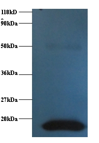 CST3 / Cystatin C Antibody - Western blot of Anti-Cystatin C antibody at 2 ug/ml + human positive serum. Secondary: Goat polyclonal to Rabbit IgG at 1:15000 dilution. Predicted band size:16 kDa. Observed band size: 16 kDa.  This image was taken for the unconjugated form of this product. Other forms have not been tested.