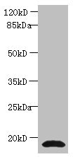 CST3 / Cystatin C Antibody - Western blot All lanes: Anti-Cystatin C antibody at 2µg/ml + human positive serumSecondary Goat polyclonal to rabbit IgG at 1/15000 dilution Predicted band size: 16 kDa Observed band size: 16 kDa