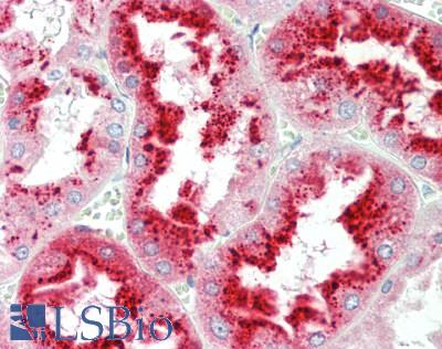 CST3 / Cystatin C Antibody - Human Kidney: Formalin-Fixed, Paraffin-Embedded (FFPE)