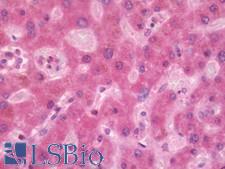 CST8 / CRES Antibody - Human Liver: Formalin-Fixed, Paraffin-Embedded (FFPE)