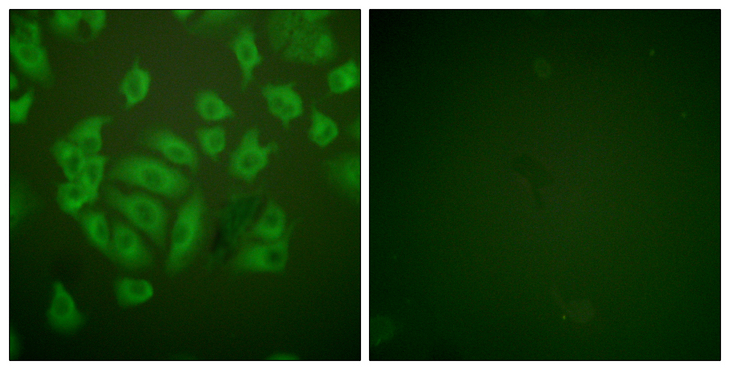 CSTA / Cystatin A Antibody - Immunofluorescence analysis of A549 cells, using Stefin A Antibody. The picture on the right is blocked with the synthesized peptide.