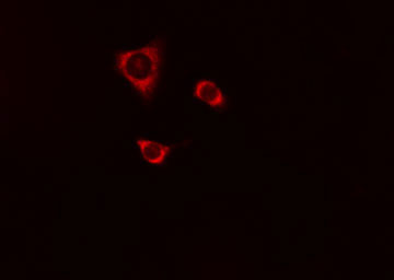 CSTA / Cystatin A Antibody - Staining A549 cells by IF/ICC. The samples were fixed with PFA and permeabilized in 0.1% Triton X-100, then blocked in 10% serum for 45 min at 25°C. The primary antibody was diluted at 1:200 and incubated with the sample for 1 hour at 37°C. An Alexa Fluor 594 conjugated goat anti-rabbit IgG (H+L) antibody, diluted at 1/600, was used as secondary antibody.