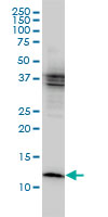 CSTB / Cystatin B / Stefin B Antibody - Western blot of CSTB expression in MCF-7 cell lysate.