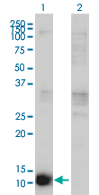 CSTB / Cystatin B / Stefin B Antibody - Western blot of CSTB expression in transfected 293T cell line by CSTB antibody. Lane 1: CSTB transfected lysate (11 KDa). Lane 2: Non-transfected lysate.