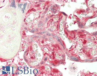 CSTB / Cystatin B / Stefin B Antibody - Human Placenta: Formalin-Fixed, Paraffin-Embedded (FFPE)