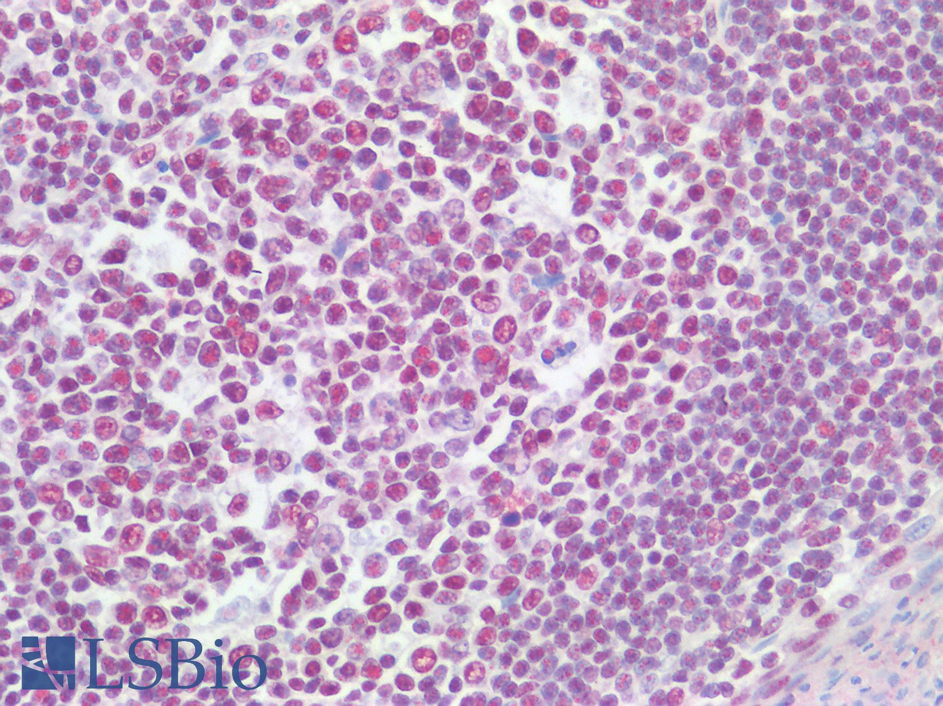CSTF2 / CstF-64 Antibody - Human Tonsil: Formalin-Fixed, Paraffin-Embedded (FFPE)