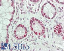 CSTF3 Antibody - Human Small Intestine: Formalin-Fixed, Paraffin-Embedded (FFPE)