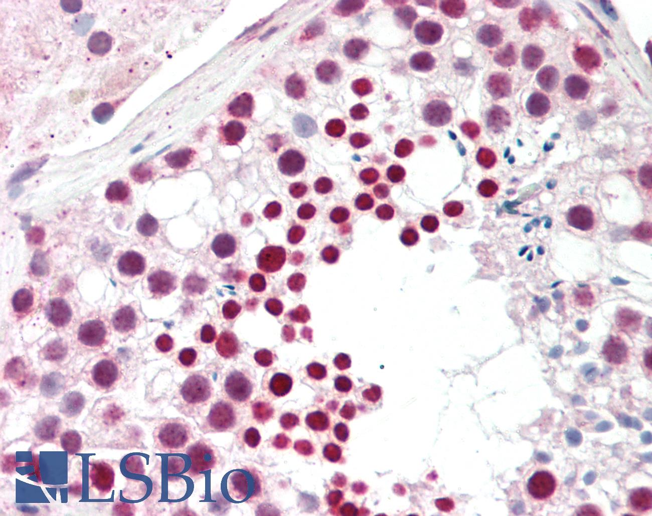 CTAG1B / NY-ESO-1 Antibody - Human Testis: Formalin-Fixed, Paraffin-Embedded (FFPE).  This image was taken for the unconjugated form of this product. Other forms have not been tested.