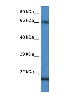 CTAG1B / NY-ESO-1 Antibody - CTAG1B / NY-ESO-1 antibody western blot of Jurkat cell lysate. Antibody concentration 1 ug/ml.  This image was taken for the unconjugated form of this product. Other forms have not been tested.