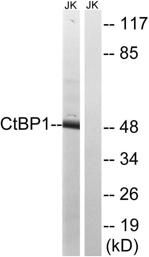 CTBP1 / CTBP Antibody - Western blot analysis of lysates from Jurkat cells, using CtBP1 Antibody. The lane on the right is blocked with the synthesized peptide.