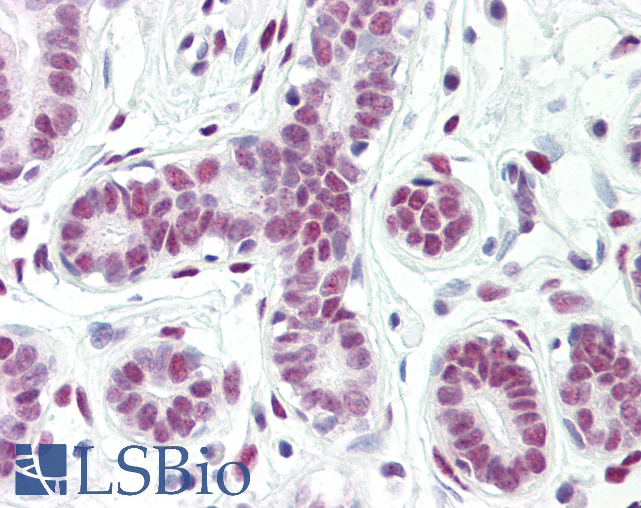 CTBP1 / CTBP Antibody - Anti-CTBP1 / CTBP antibody IHC of human breast. Immunohistochemistry of formalin-fixed, paraffin-embedded tissue after heat-induced antigen retrieval. Antibody dilution 5 ug/ml.