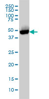 CTBP1 / CTBP Antibody - CTBP1 monoclonal antibody (M01), clone 2G7 Western blot of CTBP1 expression in HL-60.