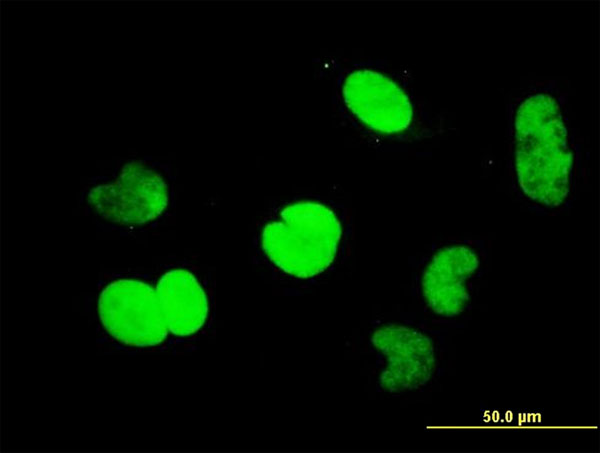 CTBP1 / CTBP Antibody - Immunofluorescence of monoclonal antibody to CTBP1 on HeLa cell. [antibody concentration 10 ug/ml]