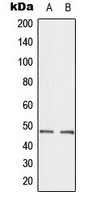 CTBP2 Antibody - Western blot analysis of CTBP2 expression in A549 (A); HepG2 (B) whole cell lysates.