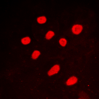 CTBP2 Antibody - Immunofluorescent analysis of CTBP2 staining in A549 cells. Formalin-fixed cells were permeabilized with 0.1% Triton X-100 in TBS for 5-10 minutes and blocked with 3% BSA-PBS for 30 minutes at room temperature. Cells were probed with the primary antibody in 3% BSA-PBS and incubated overnight at 4 C in a humidified chamber. Cells were washed with PBST and incubated with a DyLight 594-conjugated secondary antibody (red) in PBS at room temperature in the dark. DAPI was used to stain the cell nuclei (blue).