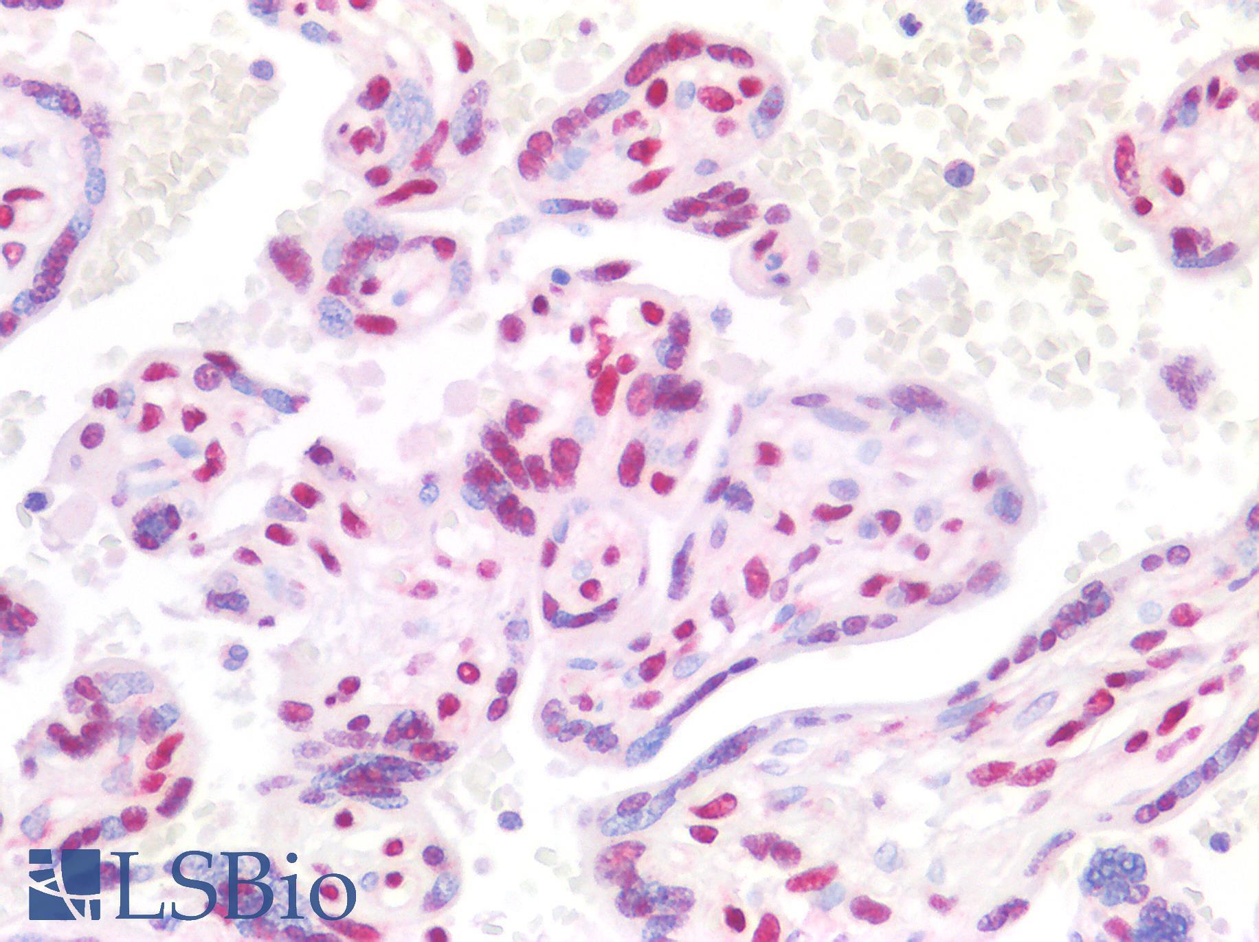 CTBP2 Antibody - Human Placenta: Formalin-Fixed, Paraffin-Embedded (FFPE)