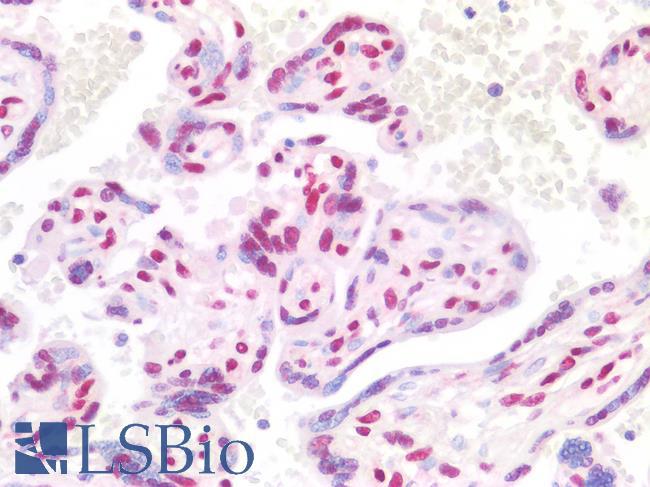 CTBP2 Antibody - Human Placenta: Formalin-Fixed, Paraffin-Embedded (FFPE)