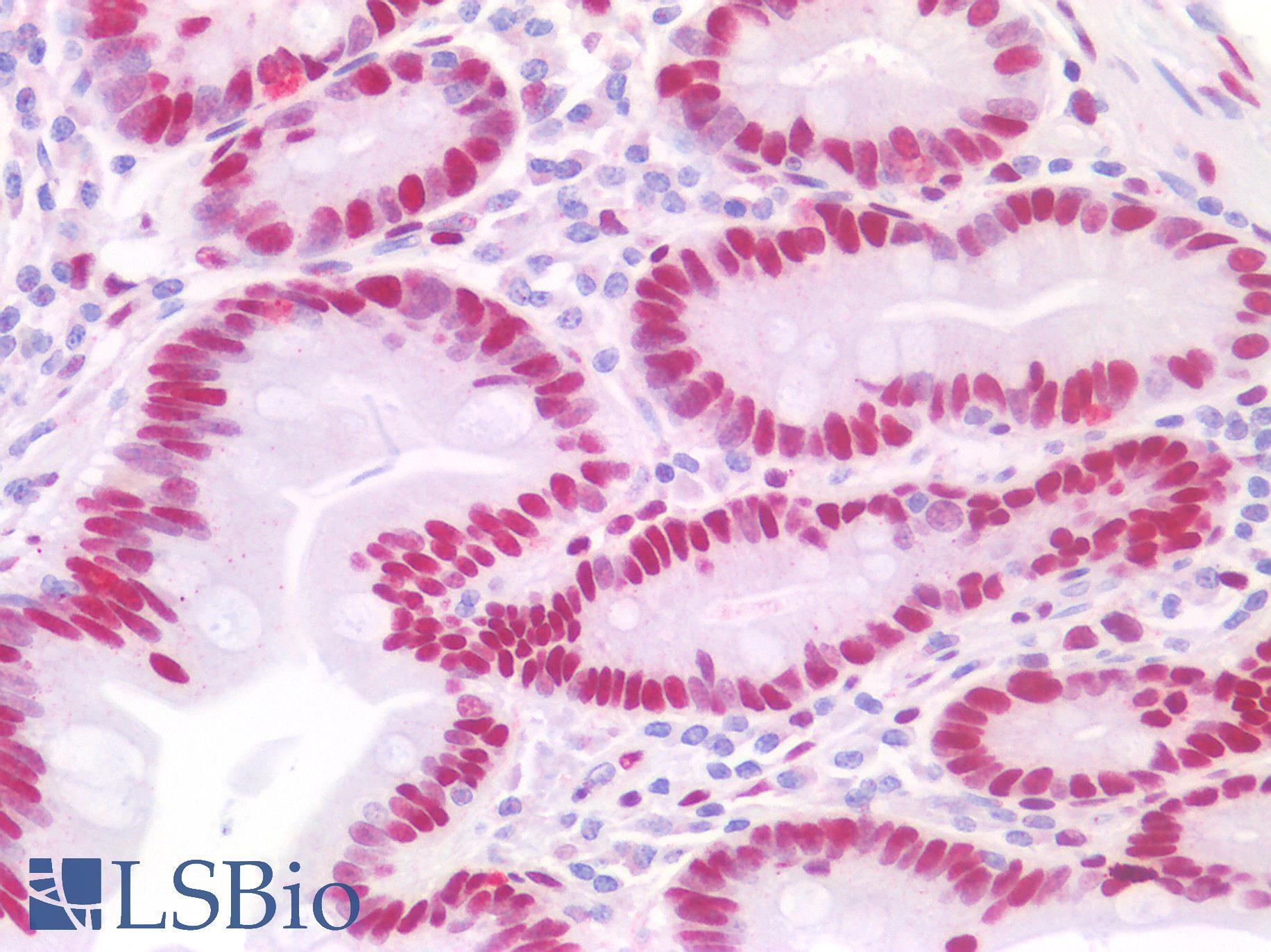 CTBP2 Antibody - Human Small Intestine: Formalin-Fixed, Paraffin-Embedded (FFPE)