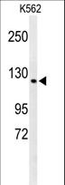 CTC1 Antibody - Western blot of CQ068 Antibody in K562 cell line lysates (35 ug/lane). CQ068 (arrow) was detected using the purified antibody.