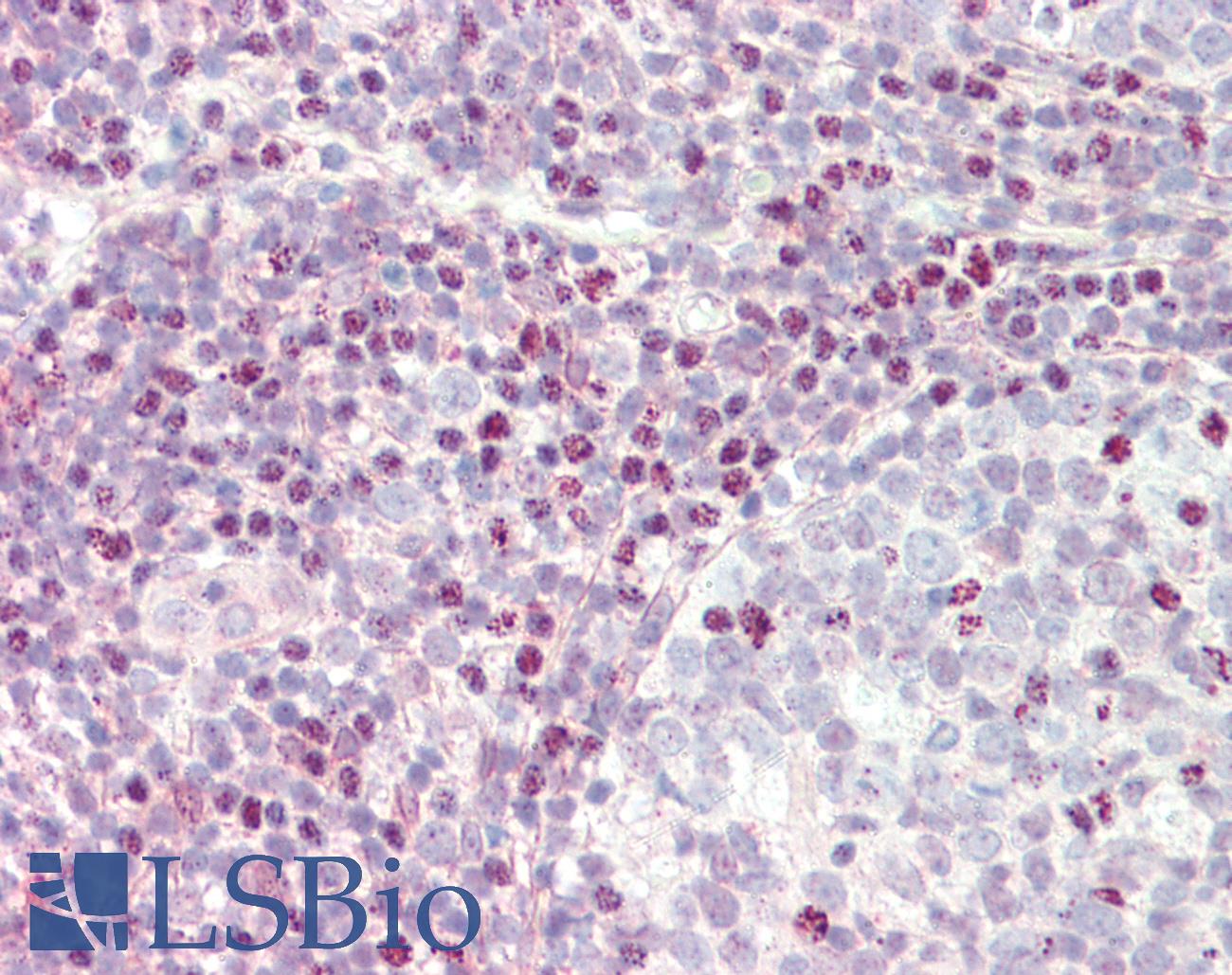 CTCF Antibody - Anti-CTCF antibody IHC staining of human tonsil. Immunohistochemistry of formalin-fixed, paraffin-embedded tissue after heat-induced antigen retrieval. Antibody concentration 5 ug/ml.