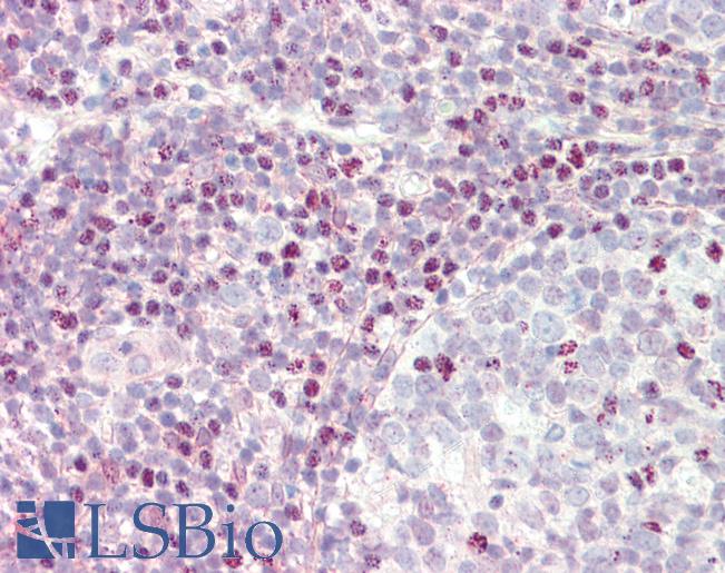 CTCF Antibody - Anti-CTCF antibody IHC staining of human tonsil. Immunohistochemistry of formalin-fixed, paraffin-embedded tissue after heat-induced antigen retrieval. Antibody concentration 5 ug/ml.